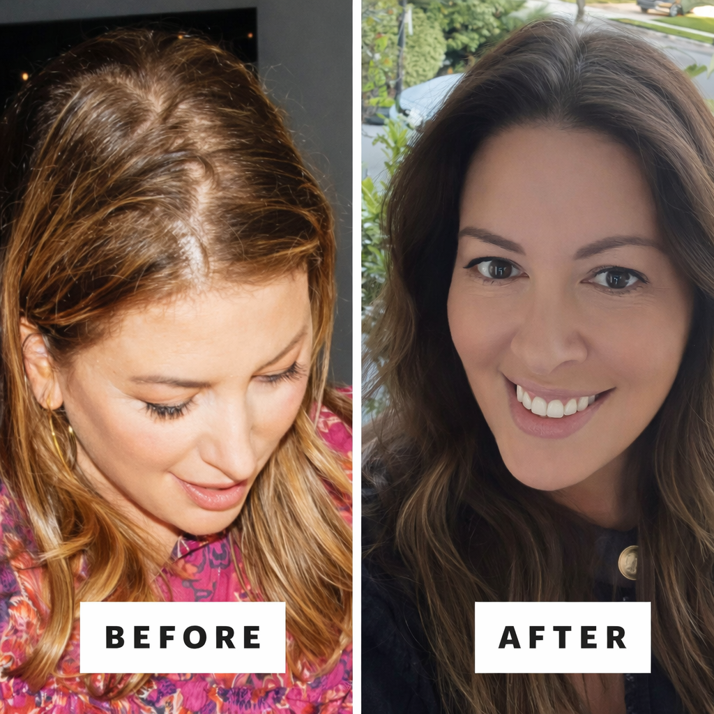 Reactivate Your Follicles. Restore Your Hair.